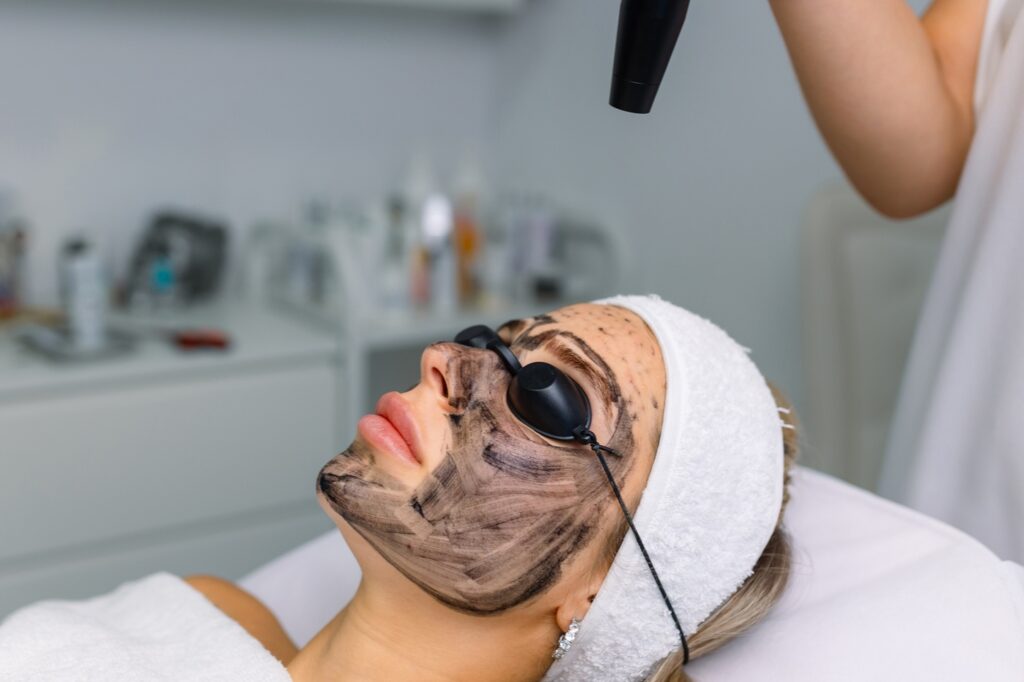 Carbon peeling kép